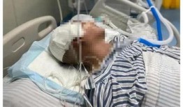 陈博士泌尿手术吃瓜群众,揭秘泌尿外科领域的创新与突破